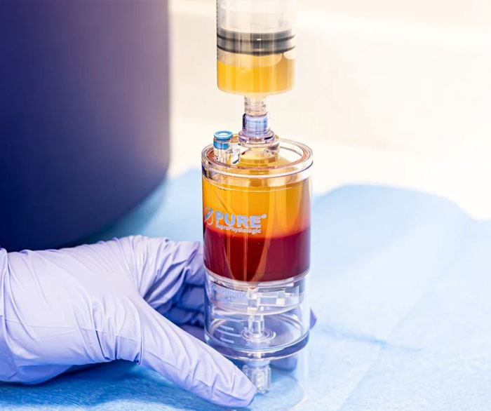 Emcyte PurePRP® SupraPhysiologic 60mL